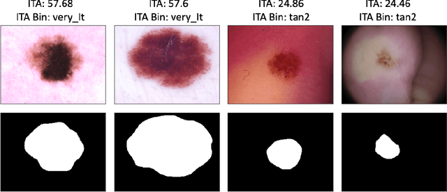 Figure 3 for Estimating Skin Tone and Effects on Classification Performance in Dermatology Datasets