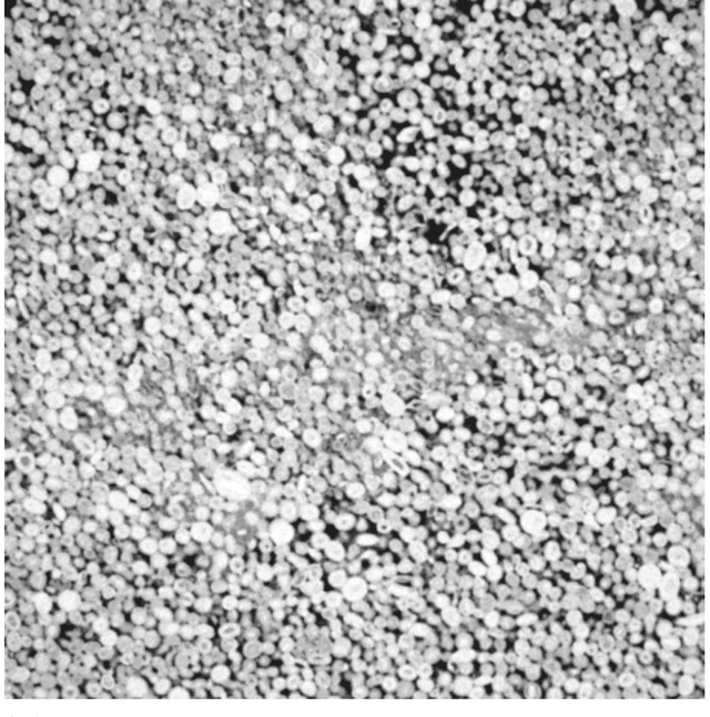 Figure 1 for Stochastic reconstruction of an oolitic limestone by generative adversarial networks
