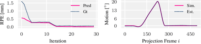 Figure 2 for Image Quality Assessment for Rigid Motion Compensation