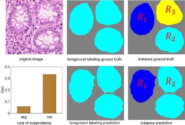Figure 3 for Gland Instance Segmentation Using Deep Multichannel Neural Networks