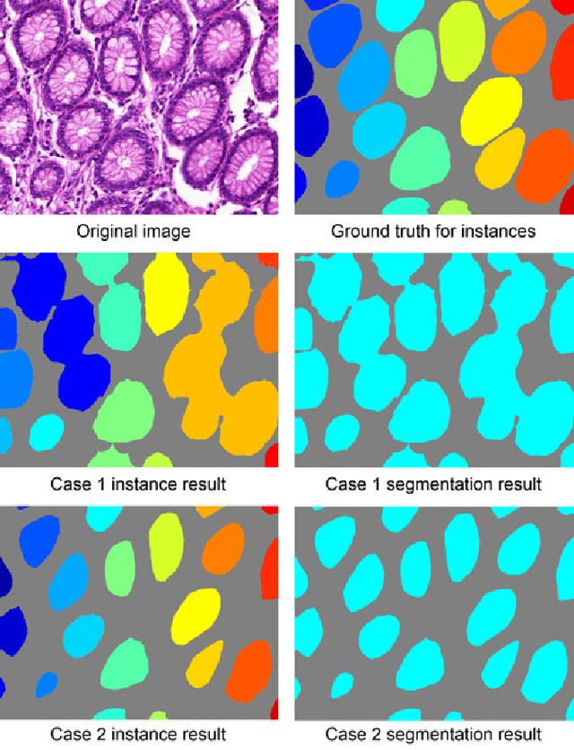 Figure 4 for Gland Instance Segmentation Using Deep Multichannel Neural Networks