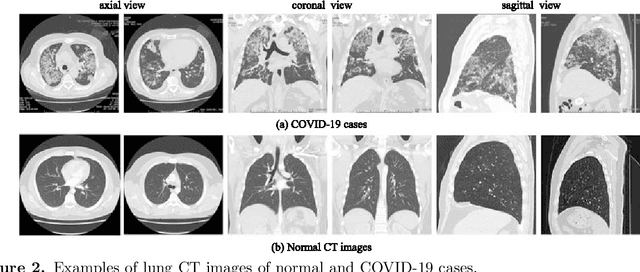 Figure 3 for A Survey on Applications of Artificial Intelligence in Fighting Against COVID-19