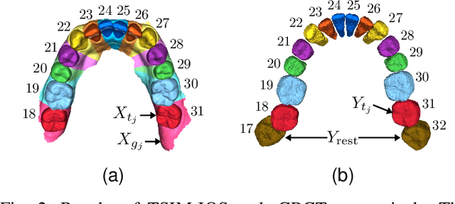 Figure 2 for Fully automatic integration of dental CBCT images and full-arch intraoral impressions with stitching error correction via individual tooth segmentation and identification