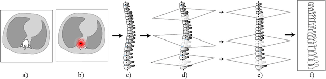 Figure 3 for Keypoints Localization for Joint Vertebra Detection and Fracture Severity Quantification
