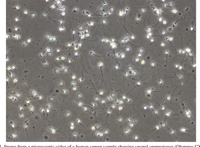 Figure 1 for Machine Learning-Based Analysis of Sperm Videos and Participant Data for Male Fertility Prediction