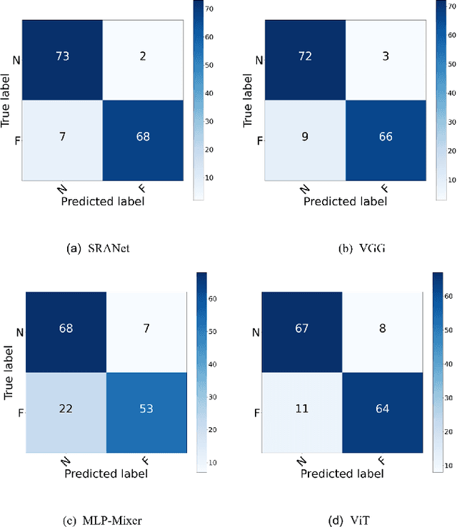 Figure 2 for Structure Regularized Attentive Network for Automatic Femoral Head Necrosis Diagnosis and Localization