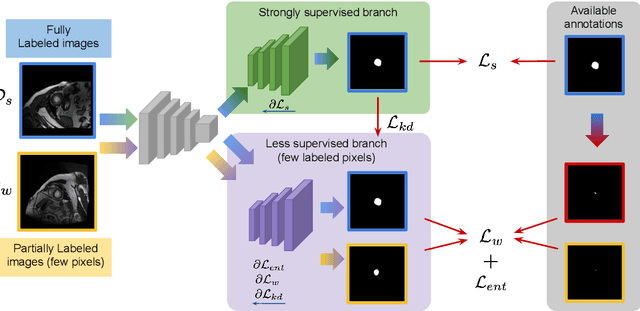Figure 1 for Mixed-supervised segmentation: Confidence maximization helps knowledge distillation