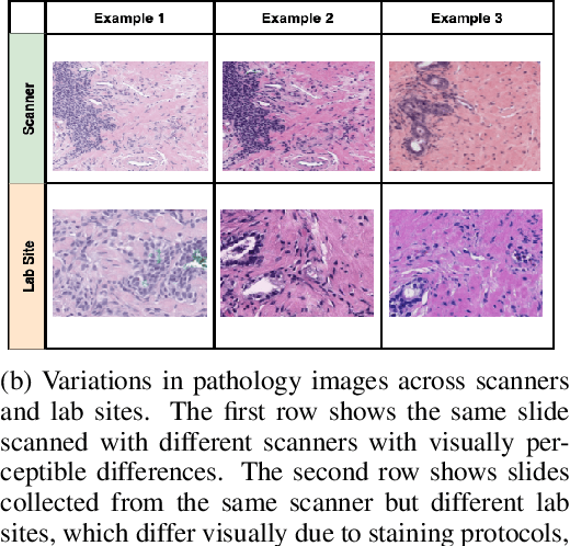 Figure 2 for Rethinking Machine Learning Model Evaluation in Pathology