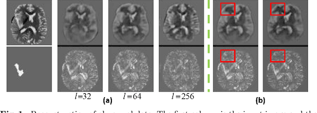 Figure 1 for Unsupervised anomaly localization using VAE and beta-VAE