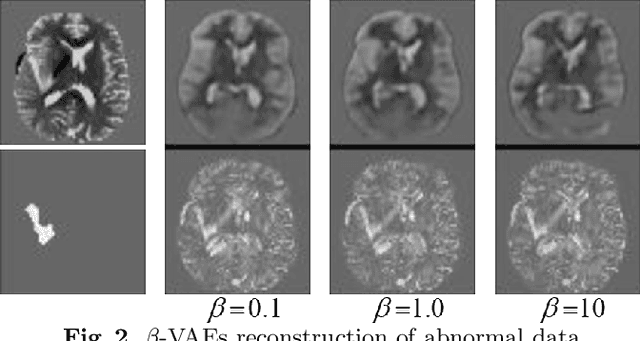 Figure 3 for Unsupervised anomaly localization using VAE and beta-VAE