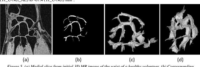 Figure 4 for CNN-based fully automatic wrist cartilage volume quantification in MR Image
