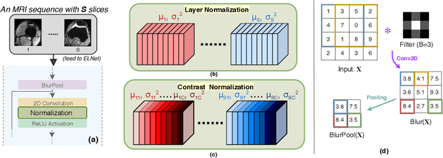 Figure 2 for Knee Injury Detection using MRI with Efficiently-Layered Network (ELNet)