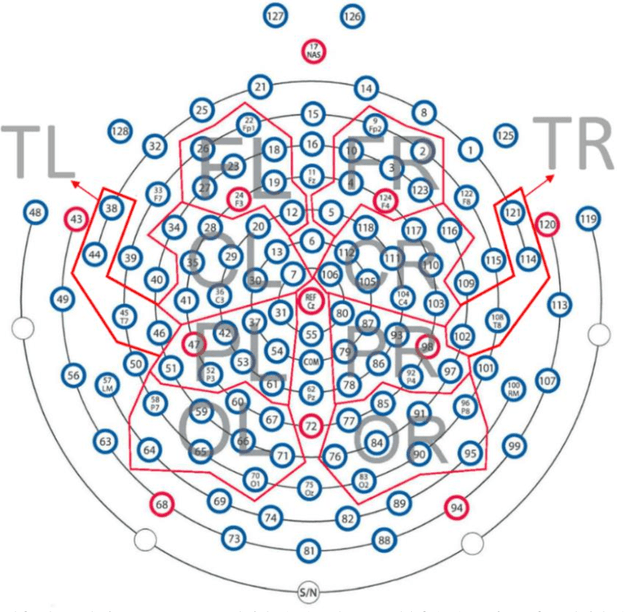 Figure 3 for An Efficient Intelligent System for the Classification of Electroencephalography (EEG) Brain Signals using Nuclear Features for Human Cognitive Tasks