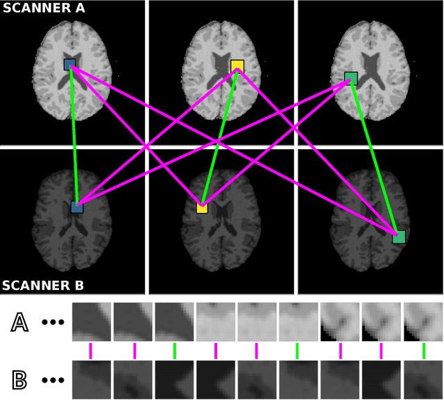 Figure 1 for MR Acquisition-Invariant Representation Learning