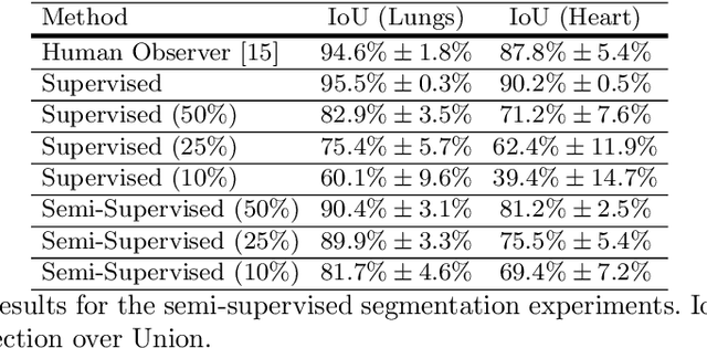 Figure 3 for Unsupervised Domain Adaptation for Automatic Estimation of Cardiothoracic Ratio
