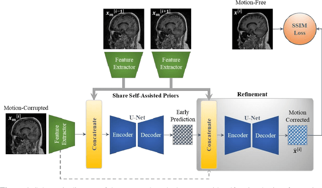 Figure 1 for Stacked U-Nets with Self-Assisted Priors Towards Robust Correction of Rigid Motion Artifact in Brain MRI