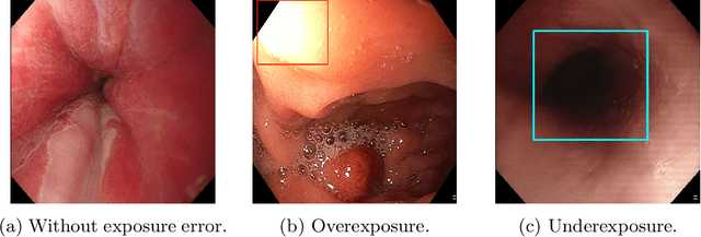 Figure 3 for A Novel Hybrid Endoscopic Dataset for Evaluating Machine Learning-based Photometric Image Enhancement Models