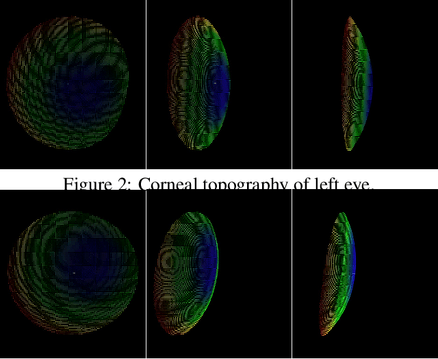 Figure 3 for OpenEDS: Open Eye Dataset