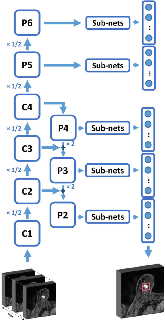 Figure 3 for Automatic Breast Lesion Detection in Ultrafast DCE-MRI Using Deep Learning