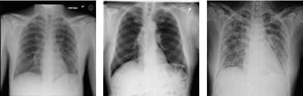 Figure 2 for Classification of COVID-19 in Chest X-ray Images Using Fusion of Deep Features and LightGBM