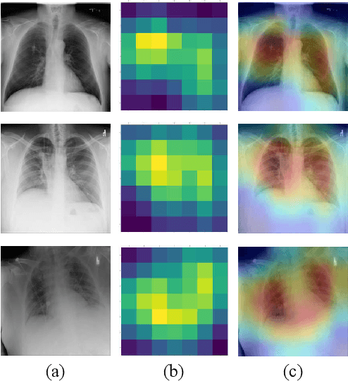 Figure 4 for Classification of COVID-19 in Chest X-ray Images Using Fusion of Deep Features and LightGBM