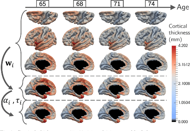 Figure 2 for Statistical learning of spatiotemporal patterns from longitudinal manifold-valued networks