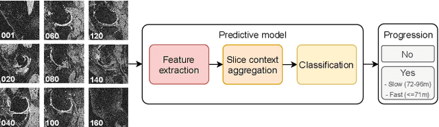 Figure 1 for Predicting Knee Osteoarthritis Progression from Structural MRI using Deep Learning