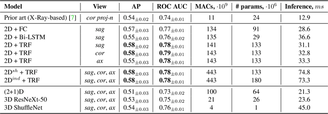 Figure 2 for Predicting Knee Osteoarthritis Progression from Structural MRI using Deep Learning