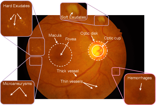Figure 1 for Parametric Scaling of Preprocessing assisted U-net Architecture for Improvised Retinal Vessel Segmentation