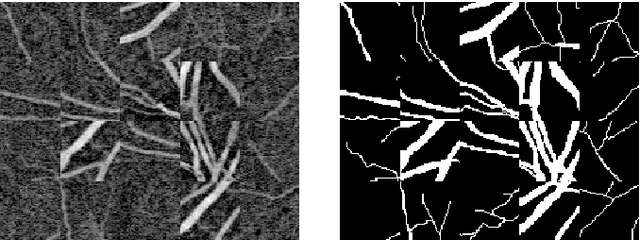 Figure 4 for Parametric Scaling of Preprocessing assisted U-net Architecture for Improvised Retinal Vessel Segmentation
