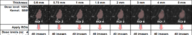 Figure 3 for Are Quantitative Features of Lung Nodules Reproducible at Different CT Acquisition and Reconstruction Parameters?