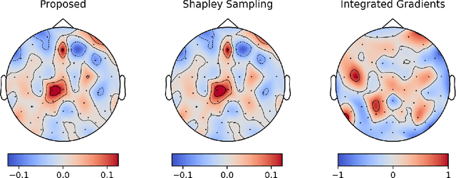 Figure 3 for Compensated Integrated Gradients to Reliably Interpret EEG Classification