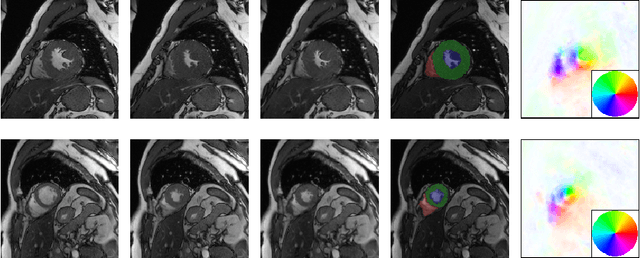 Figure 3 for Motion Pyramid Networks for Accurate and Efficient Cardiac Motion Estimation