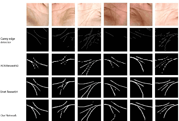 Figure 4 for Efficient Palm-Line Segmentation with U-Net Context Fusion Module