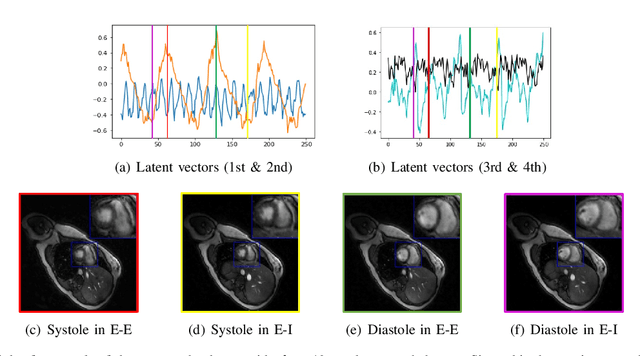 Figure 2 for Dynamic imaging using a deep generative SToRM model