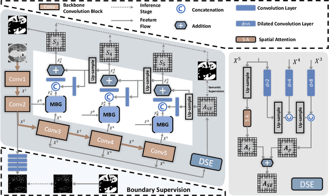 Figure 2 for Boundary Guided Semantic Learning for Real-time COVID-19 Lung Infection Segmentation System