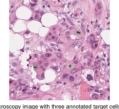 Figure 1 for Training Convolutional Neural Networks and Compressed Sensing End-to-End for Microscopy Cell Detection