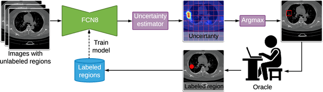 Figure 4 for A Weakly Supervised Region-Based Active Learning Method for COVID-19 Segmentation in CT Images