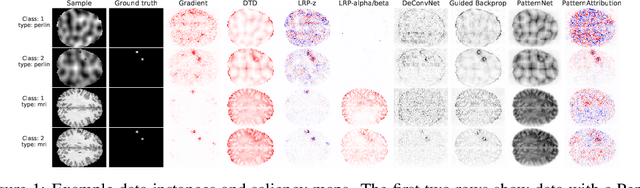 Figure 1 for Evaluating saliency methods on artificial data with different background types