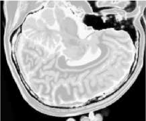 Figure 1 for Fuzzy-Based Dialectical Non-Supervised Image Classification and Clustering