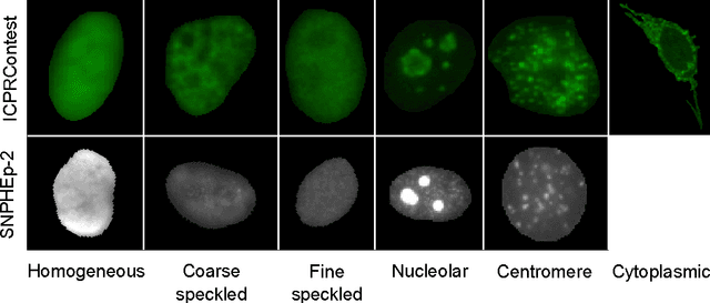 Figure 3 for Automatic Classification of Human Epithelial Type 2 Cell Indirect Immunofluorescence Images using Cell Pyramid Matching