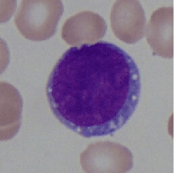Figure 1 for Quaternion-Valued Convolutional Neural Network Applied for Acute Lymphoblastic Leukemia Diagnosis