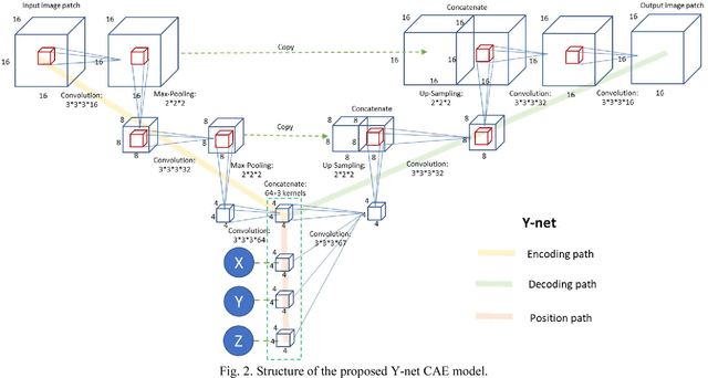 Figure 2 for Y-net: 3D intracranial artery segmentation using a convolutional autoencoder