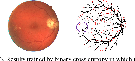 Figure 4 for Connection Sensitive Attention U-NET for Accurate Retinal Vessel Segmentation