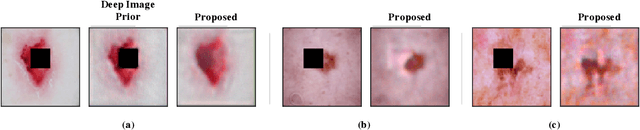 Figure 3 for Using Deep Image Priors to Generate Counterfactual Explanations