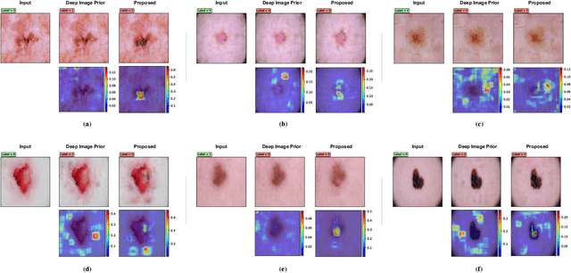 Figure 4 for Using Deep Image Priors to Generate Counterfactual Explanations