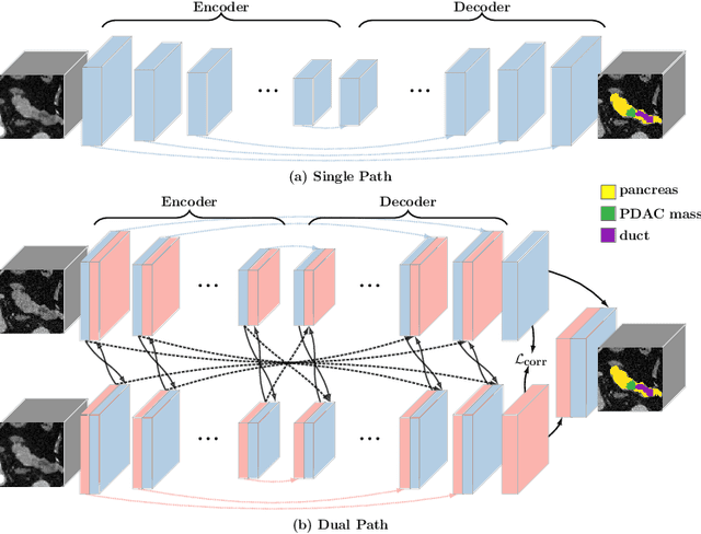 Figure 3 for Hyper-Pairing Network for Multi-Phase Pancreatic Ductal Adenocarcinoma Segmentation