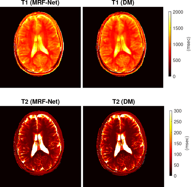 Figure 1 for Geometry of Deep Learning for Magnetic Resonance Fingerprinting