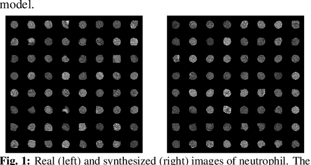Figure 1 for Generative Spatiotemporal Modeling Of Neutrophil Behavior