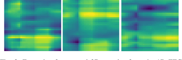 Figure 3 for Grasp-and-Lift Detection from EEG Signal Using Convolutional Neural Network
